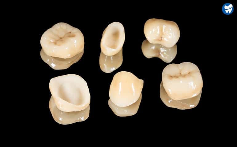 All-ceramic crowns