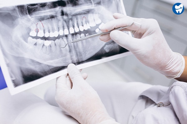 Teeth X-rays