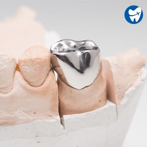 Metal Dental Crown