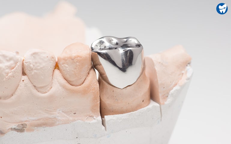 Metal dental crown