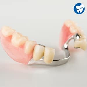 Partial denture