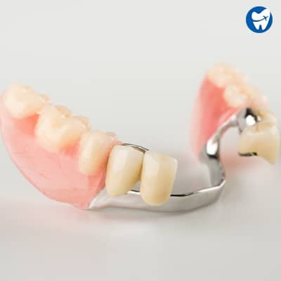 Removable Partial Dentures