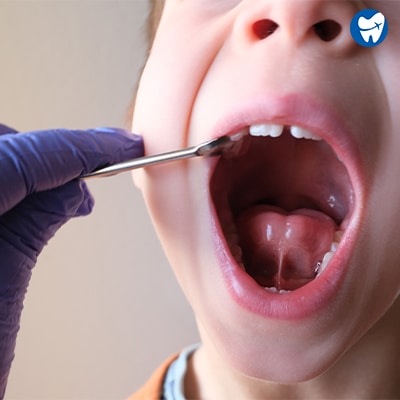 Dentist examines oral cavity of pediatric patient with tongue-tie