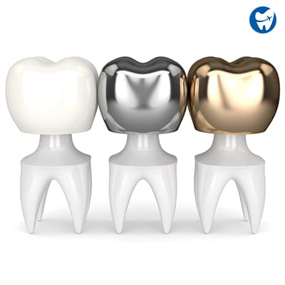 Types of dental crowns 