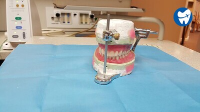 Fabrication of denture