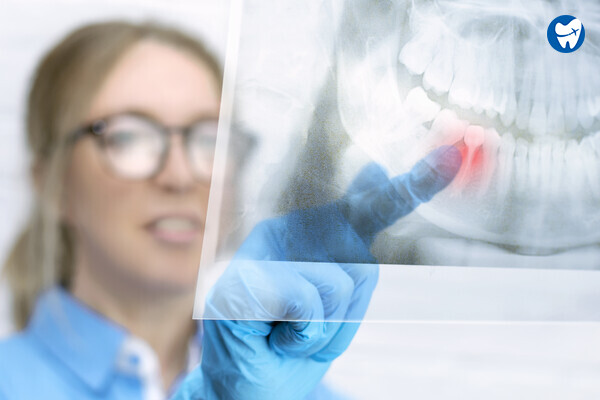 Dentist checking oral X-ray