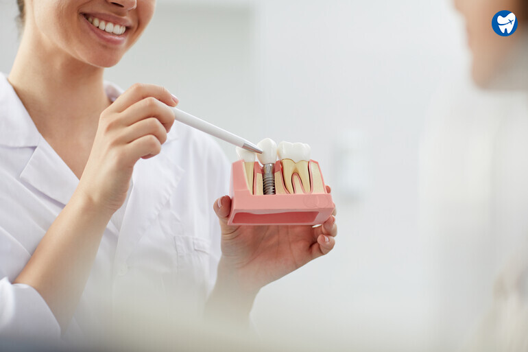 Dentist explaining dental implant