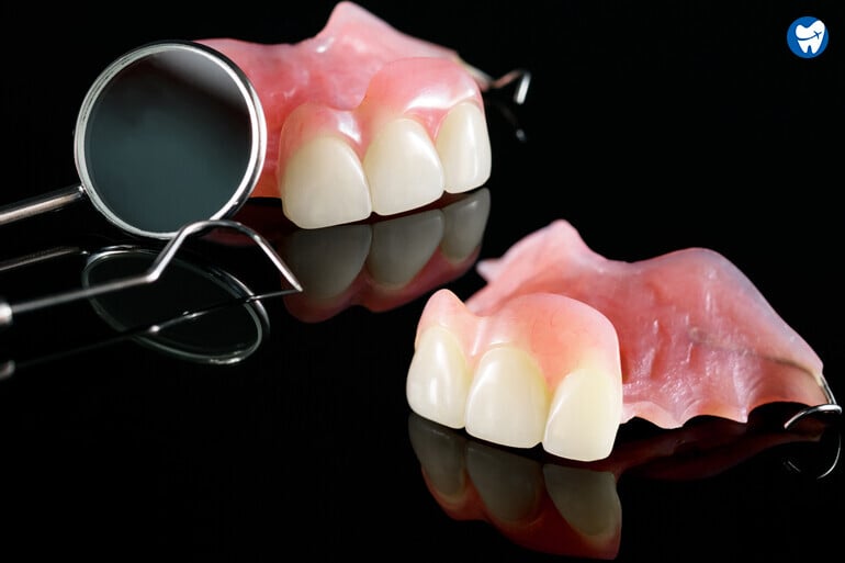 Removable Partial Denture