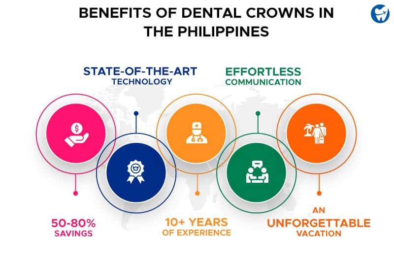 Benefits of Dental Crowns in the Philippines