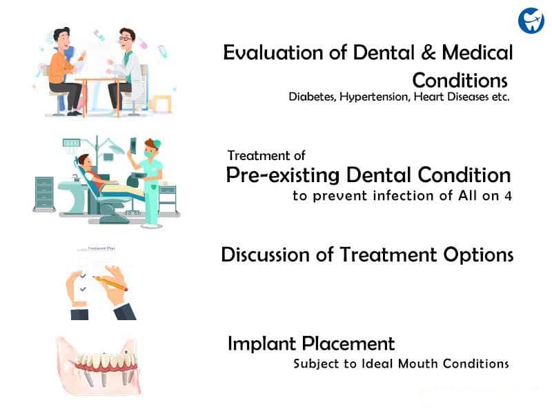 Consultation for All on6/8 dental implants