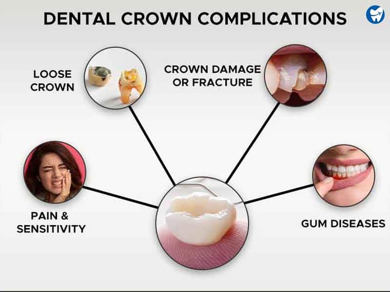 Tooth crown complications
