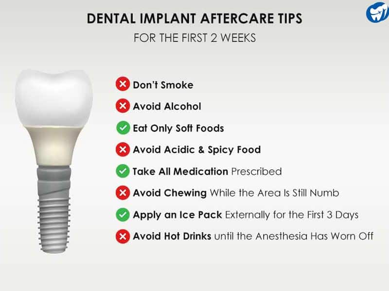 Dental Implant Aftercare