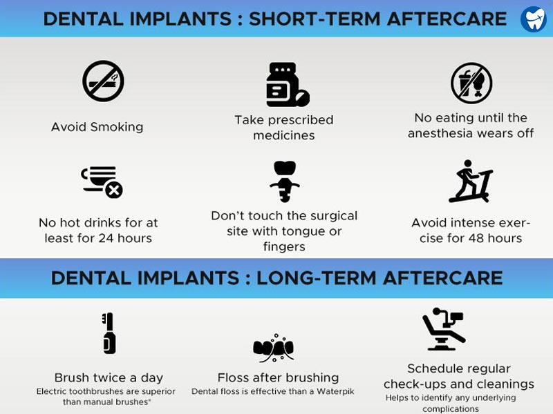 Dental implants - Aftercare tips