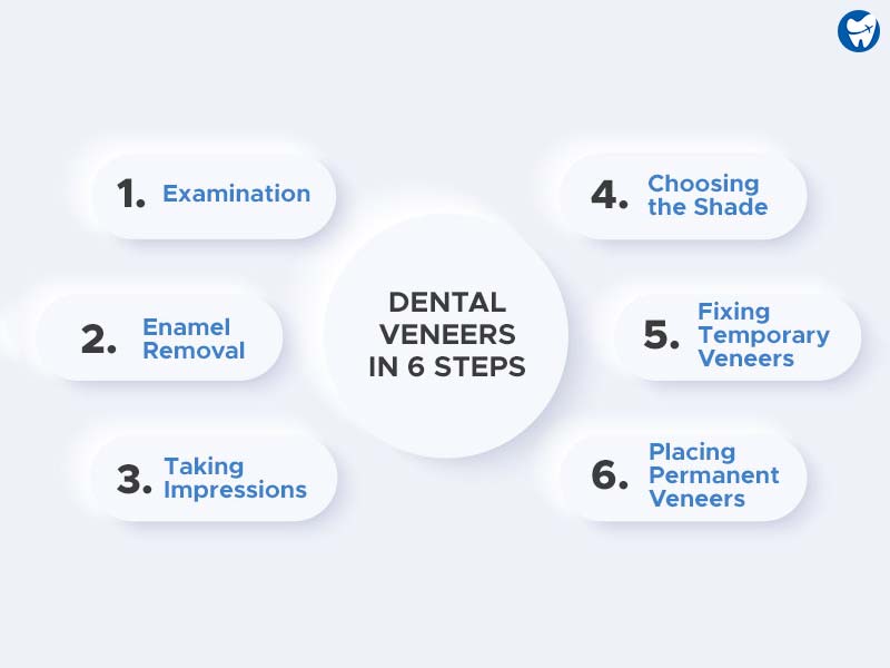Dental Veneer Steps in Croatia