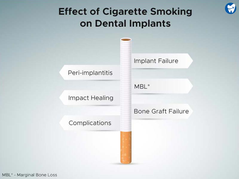 Effects of Cigarette Smoking on Dental Implants