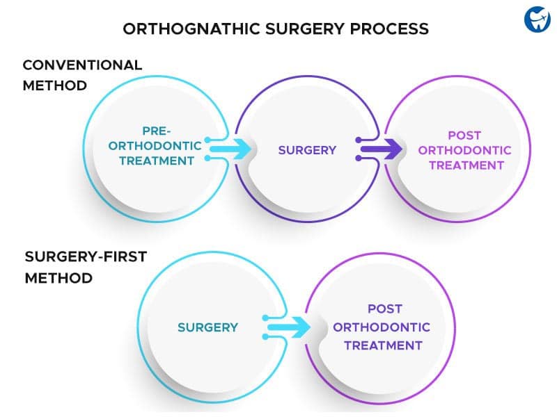 Orthognathic Surgery Process