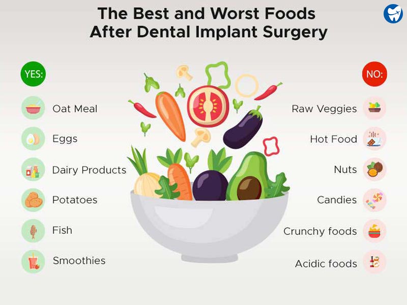 https://www.dentavacation.com/wp-content/uploads/2022/08/Post-Dental-Implant-Surgery-Diet-Infographic.jpg