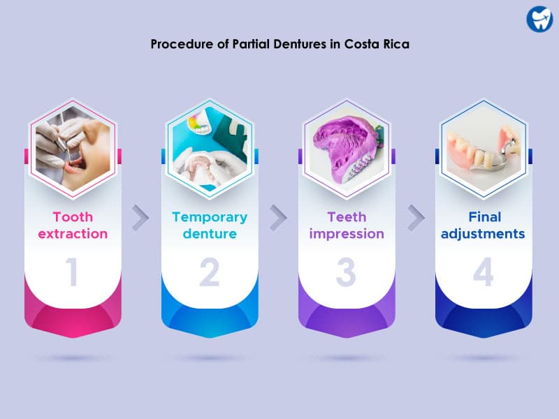 Procedure for Partial Dentures in Costa Rica