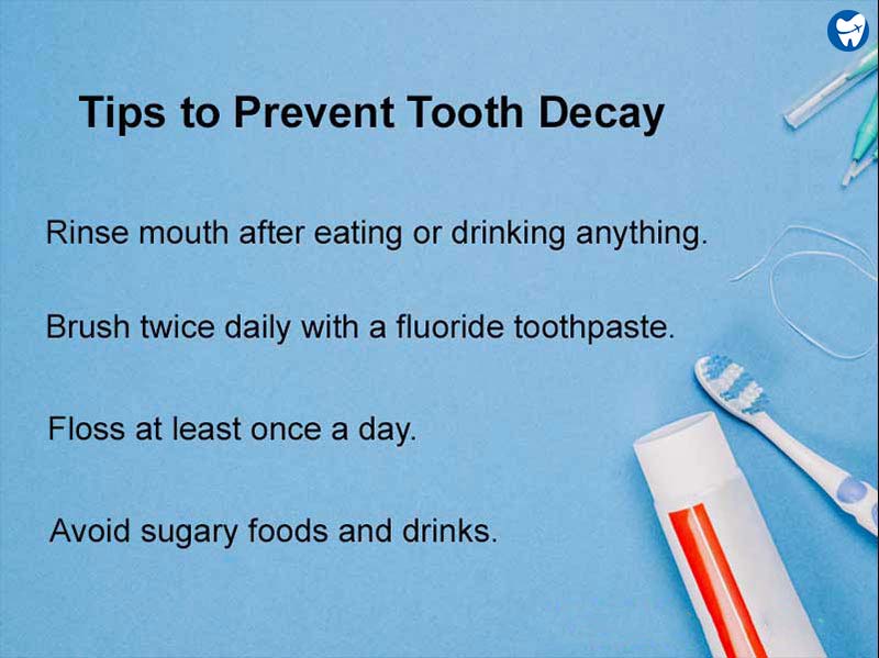 Tooth decay prevention tips
