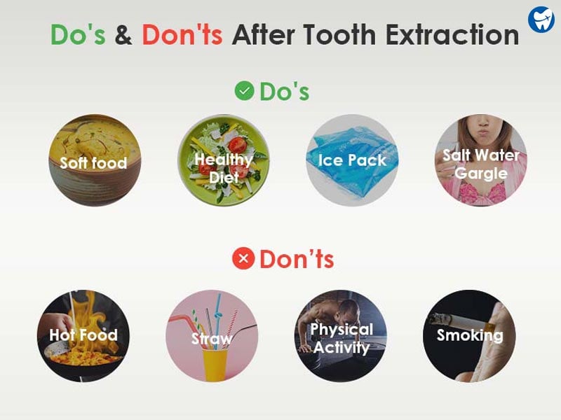 Should I drink cold or warm water after tooth extraction?