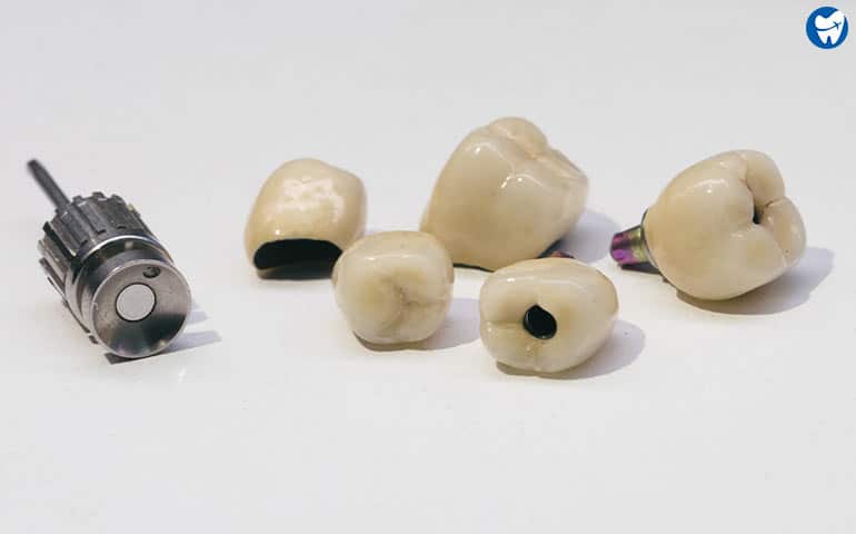 Zirconia Crowns in Tijuana, Mexico