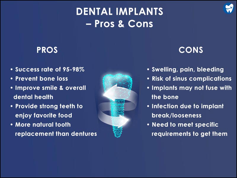 Pros & Cons of Dental Implant
