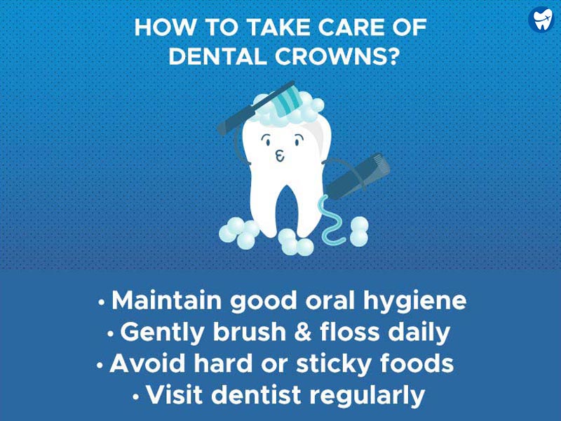 Care of Your Dental Crown