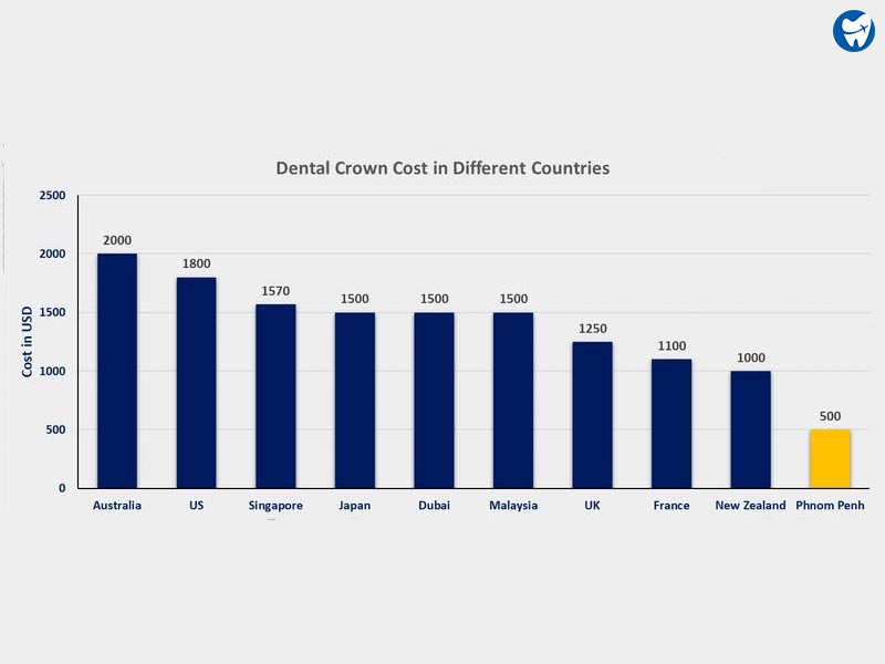 Dental Crown Cost in different countries