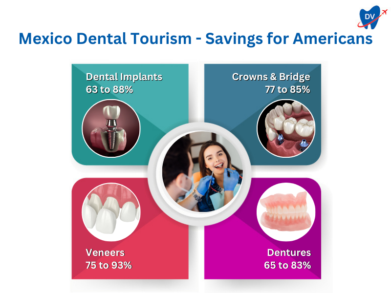 Dental Tourism in Mexico | Cost Savings