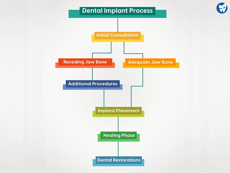 Dental Implant Process in Croatia