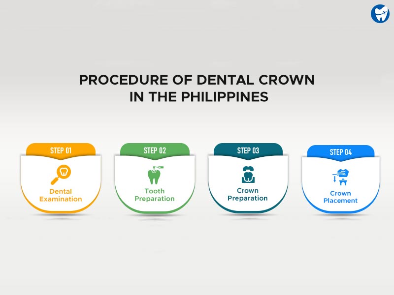 Procedure of Dental Crowns in the Philippines