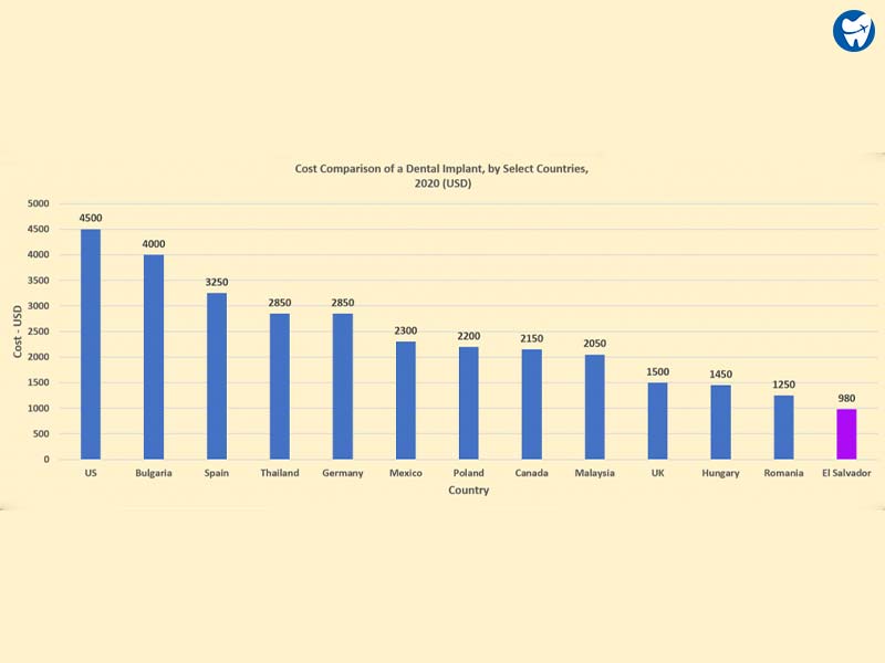 Cost Comparison of a Dental Implant in different countries