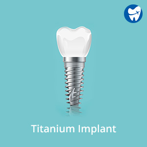 Titanium dental implant