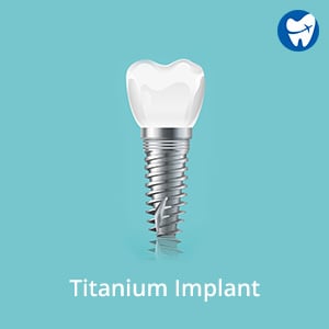 Titanium Implant in Izmir, Turkey