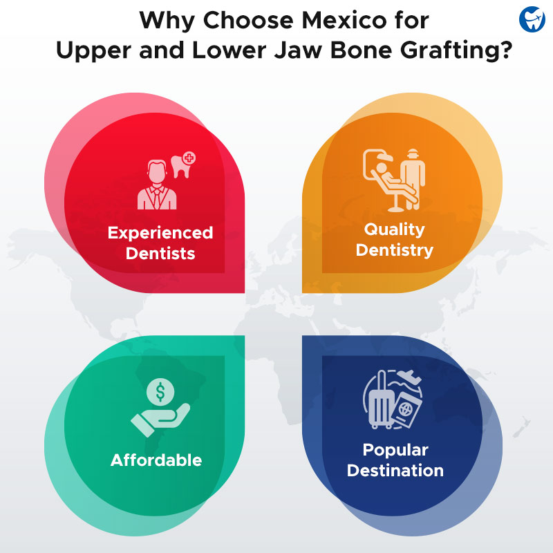 Benefits of Upper and Lower Jaw Bone Grafting in Mexico