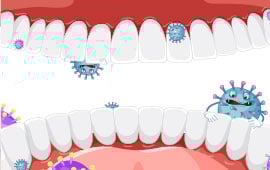 Gum Disease