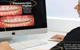 Digital Smile