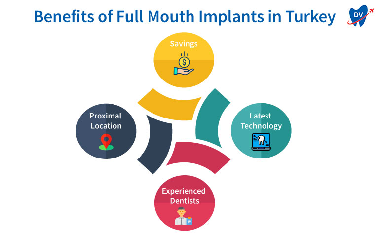 Benefits of Full Mouth Implants in Turkey