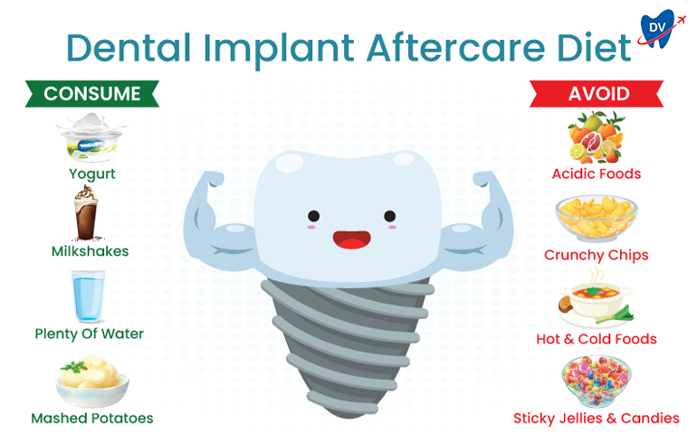 Aftercare diet for dental implants