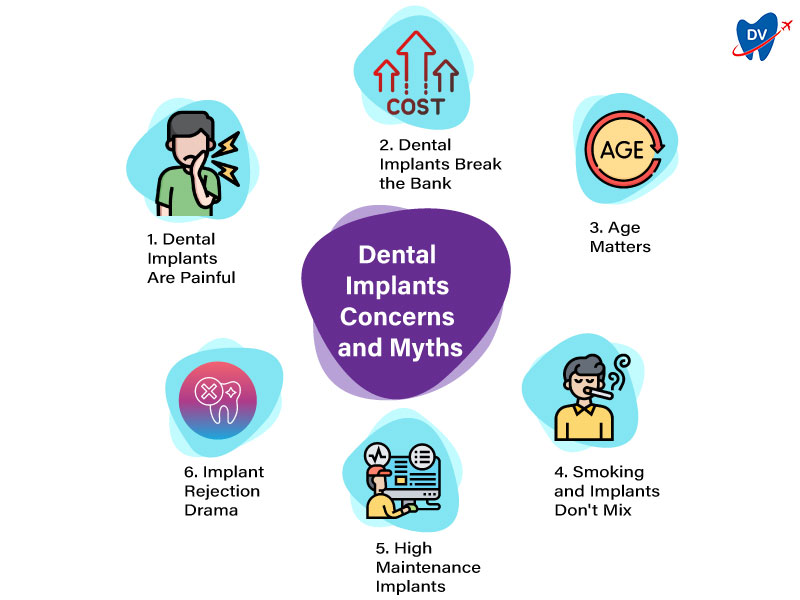 Bucharest Dental Implants Myths