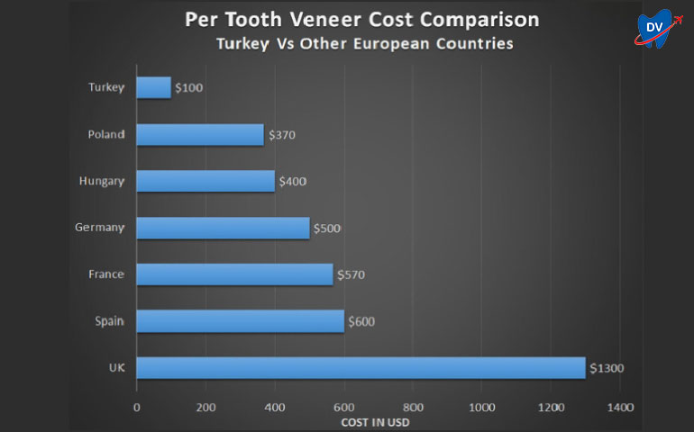 Veneers Cost Turkey vs. Other European Countries