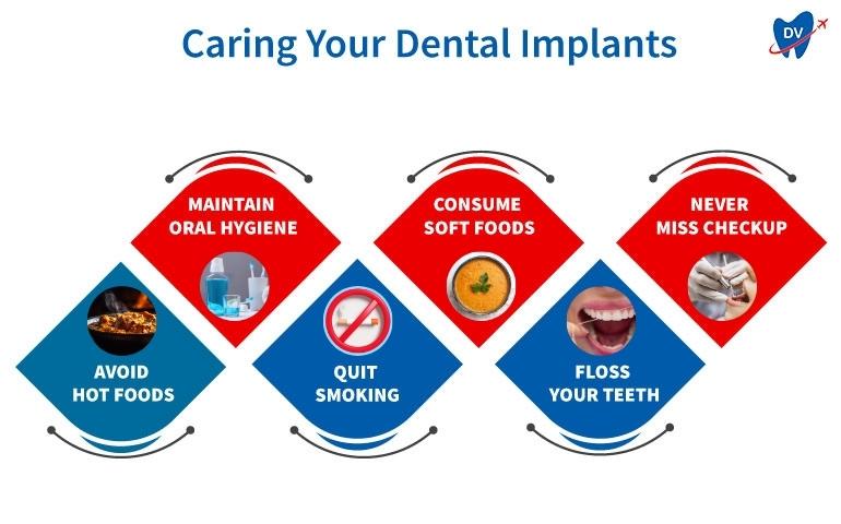 How To Care for Your All-on-4 Dental Implants?