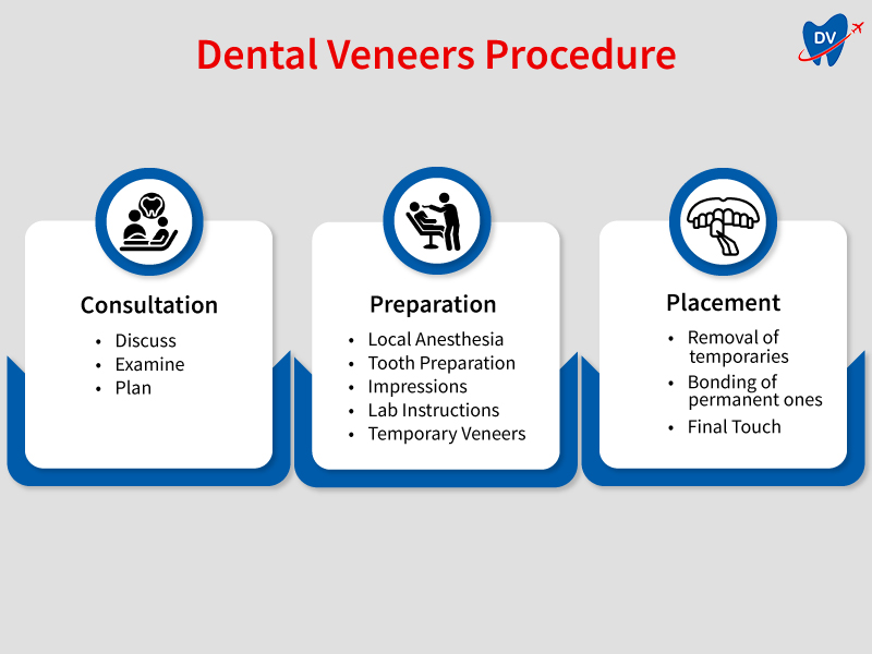 Dental Veneers Procedure