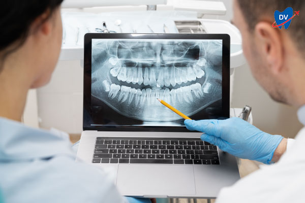Understanding patient condition using Dental X ray 