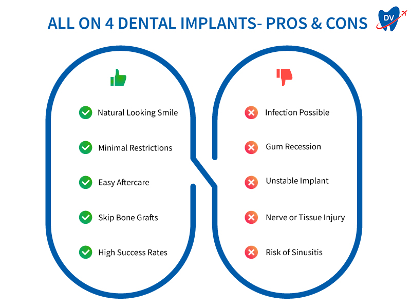 All on 4 Dental Implants pros and cons