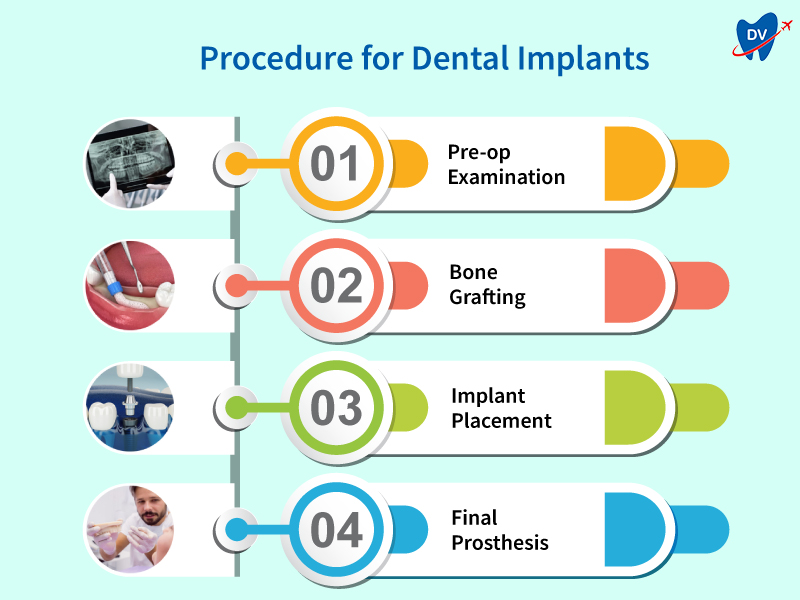 Procedure for Dental Implants in Indonesia