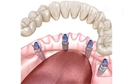 Permanent Teeth